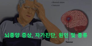 뇌종양 증상, 자가진단, 원인 및 종류