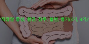 직장암 증상, 원인, 장루, 혈변, 병기(3기, 4기)
