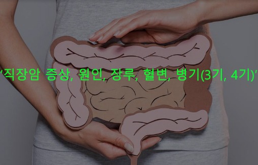 직장암 증상, 원인, 장루, 혈변, 병기(3기, 4기)