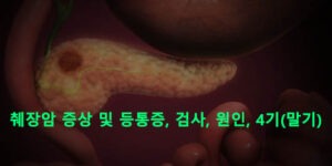 췌장암 증상 및 등통증, 검사, 원인, 4기(말기)