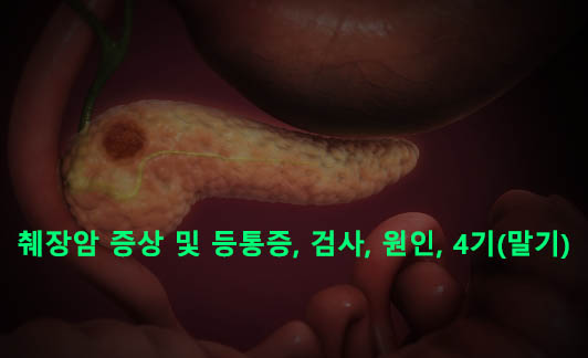 췌장암 증상 및 등통증, 검사, 원인, 4기(말기)