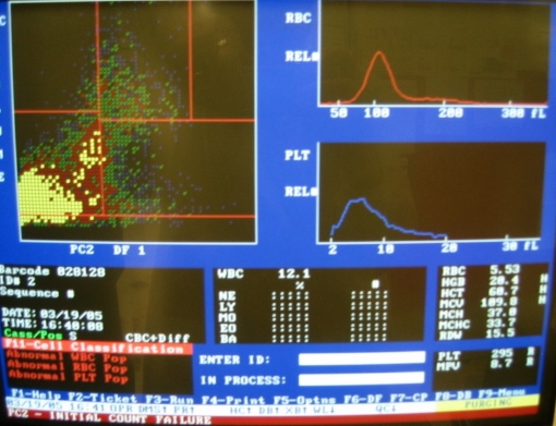 BUN 수치 상승 원인