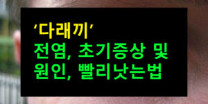 다래끼 전염, 초기증상 및 원인, 빨리낫는법