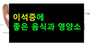 이석증에 좋은 음식과 영양소
