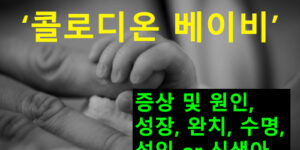 콜로디온 베이비 증상 및 원인, 성장, 완치, 수명, 성인 or 신생아