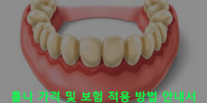 틀니 가격 및 보험 적용 방법 안내서